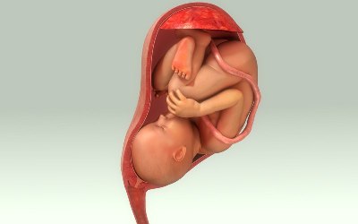 Приращение плаценты: истинное и ложное. Когда необходимо ручное отделение плаценты после родов. Чем грозит полное и частичное приращение плаценты. Можно ли сохранить матку после беременности с приращением плаценты.