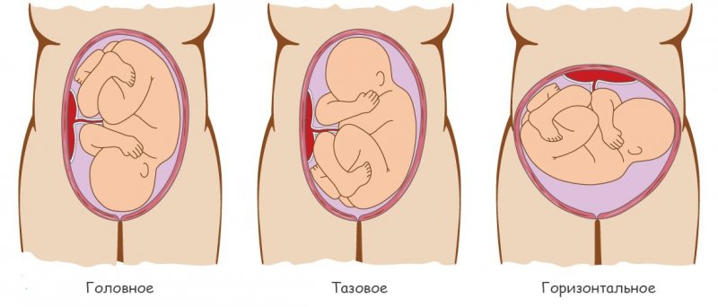 Как беременная может сама определить положение плода в матке?